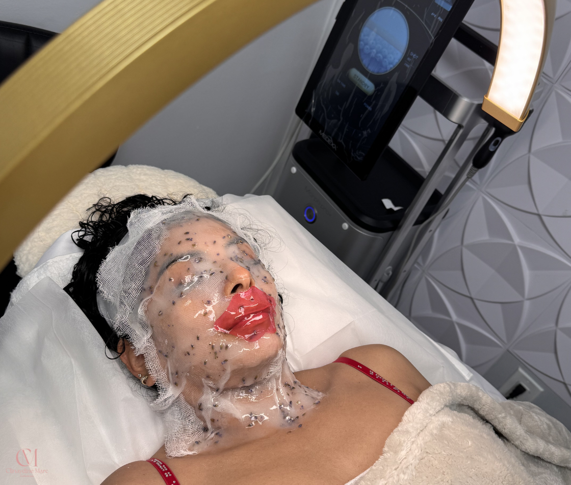Tratamiento Facial VIP en Progreso